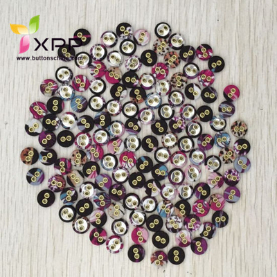 Customized Fabric Covered Button